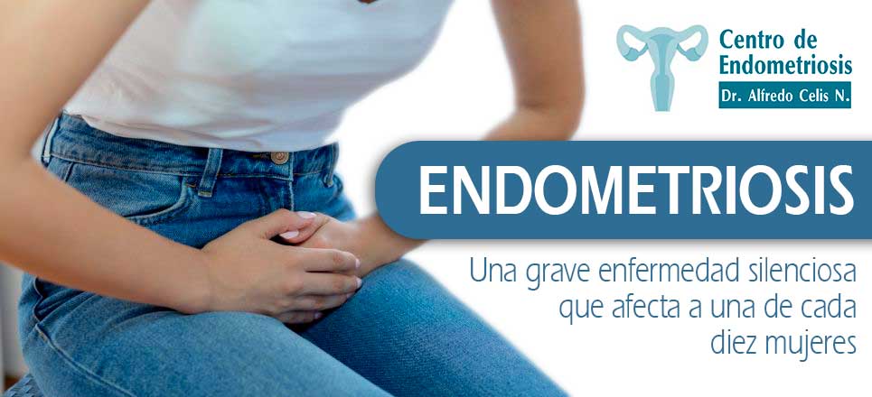 Endometriosis